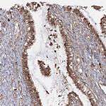 RPS25 Antibody in Immunohistochemistry (IHC)