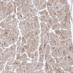 RPS25 Antibody in Immunohistochemistry (IHC)