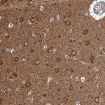 SNAP29 Antibody in Immunohistochemistry (Paraffin) (IHC (P))