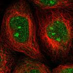 ALG14 Antibody in Immunocytochemistry (ICC/IF)