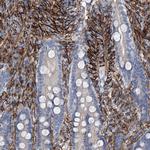 ALG14 Antibody in Immunohistochemistry (Paraffin) (IHC (P))