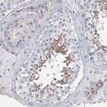 ALG14 Antibody in Immunohistochemistry (Paraffin) (IHC (P))