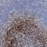 ALG14 Antibody in Immunohistochemistry (Paraffin) (IHC (P))