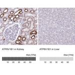 ATP6V1B1 Antibody in Immunohistochemistry (IHC)