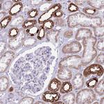 ATP6V1B1 Antibody in Immunohistochemistry (IHC)