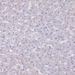 ATP6V1B1 Antibody in Immunohistochemistry (IHC)