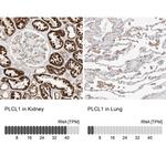 PLCL1 Antibody in Immunohistochemistry (IHC)