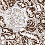 PLCL1 Antibody in Immunohistochemistry (IHC)