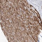 PLCL1 Antibody in Immunohistochemistry (IHC)