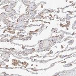 PLCL1 Antibody in Immunohistochemistry (IHC)