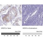 DPEP3 Antibody in Immunohistochemistry (IHC)