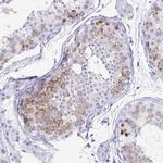 DPEP3 Antibody in Immunohistochemistry (IHC)