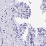 DPEP3 Antibody in Immunohistochemistry (IHC)