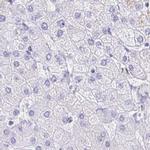 DPEP3 Antibody in Immunohistochemistry (IHC)