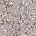 ICMT Antibody in Immunohistochemistry (Paraffin) (IHC (P))