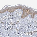 ICMT Antibody in Immunohistochemistry (Paraffin) (IHC (P))