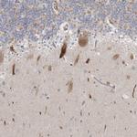 ICMT Antibody in Immunohistochemistry (IHC)