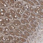 PUSL1 Antibody in Immunohistochemistry (Paraffin) (IHC (P))