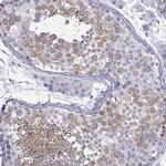 KIF17 Antibody in Immunohistochemistry (IHC)