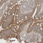 UHRF1BP1 Antibody in Immunohistochemistry (Paraffin) (IHC (P))