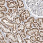 UHRF1BP1 Antibody in Immunohistochemistry (IHC)