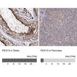 PEX13 Antibody in Immunohistochemistry (IHC)