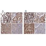 PEX13 Antibody in Immunohistochemistry (IHC)