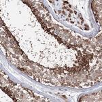 PEX13 Antibody in Immunohistochemistry (IHC)