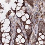 PEX13 Antibody in Immunohistochemistry (IHC)