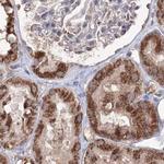 PEX13 Antibody in Immunohistochemistry (IHC)