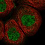 LDB1 Antibody in Immunocytochemistry (ICC/IF)