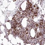 LDB1 Antibody in Immunohistochemistry (Paraffin) (IHC (P))