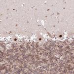 LDB1 Antibody in Immunohistochemistry (Paraffin) (IHC (P))