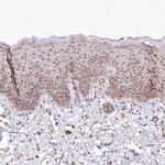 LDB1 Antibody in Immunohistochemistry (Paraffin) (IHC (P))