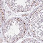 LDB1 Antibody in Immunohistochemistry (Paraffin) (IHC (P))