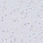 PTPRO Antibody in Immunohistochemistry (IHC)