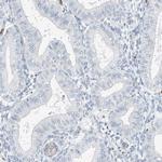 RCAN3 Antibody in Immunohistochemistry (IHC)