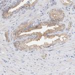 RCAN3 Antibody in Immunohistochemistry (IHC)