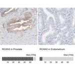 RCAN3 Antibody