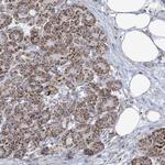 SAMM50 Antibody in Immunohistochemistry (Paraffin) (IHC (P))