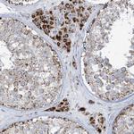 SAMM50 Antibody in Immunohistochemistry (Paraffin) (IHC (P))