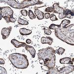 MAN1A2 Antibody in Immunohistochemistry (IHC)