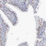 MAN1A2 Antibody in Immunohistochemistry (IHC)