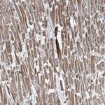 TMLHE Antibody in Immunohistochemistry (Paraffin) (IHC (P))