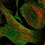 SYNPO Antibody in Immunocytochemistry (ICC/IF)