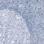 SYNPO Antibody in Immunohistochemistry (IHC)