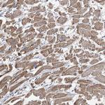 COMMD1 Antibody in Immunohistochemistry (Paraffin) (IHC (P))