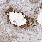 CHCHD4 Antibody in Immunohistochemistry (Paraffin) (IHC (P))