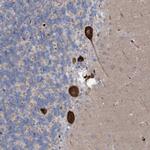 RBMS3 Antibody in Immunohistochemistry (Paraffin) (IHC (P))