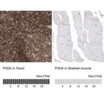 PSD4 Antibody in Immunohistochemistry (IHC)